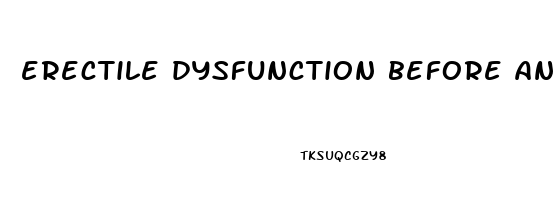 erectile dysfunction before and after photos