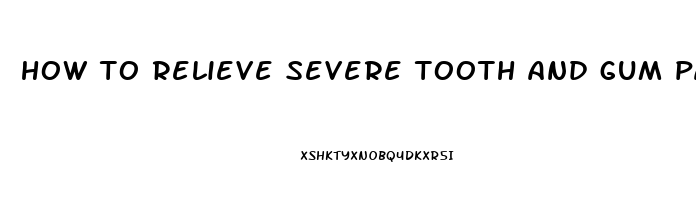 how to relieve severe tooth and gum pain