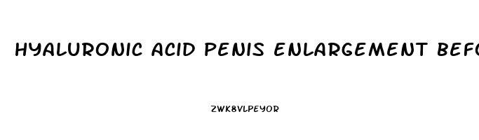 hyaluronic acid penis enlargement before and after