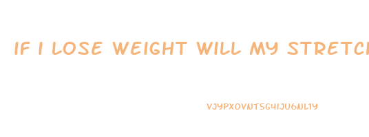 if i lose weight will my stretch marks go away