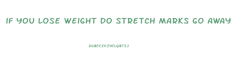 if you lose weight do stretch marks go away