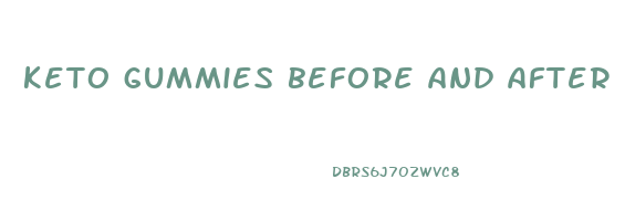 keto gummies before and after pictures