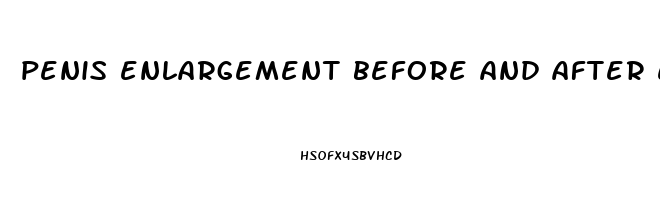 penis enlargement before and after erect