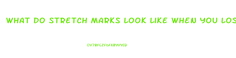 what do stretch marks look like when you lose weight