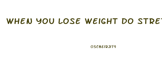 when you lose weight do stretch marks go away
