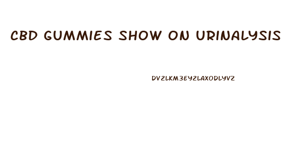 Cbd Gummies Show On Urinalysis