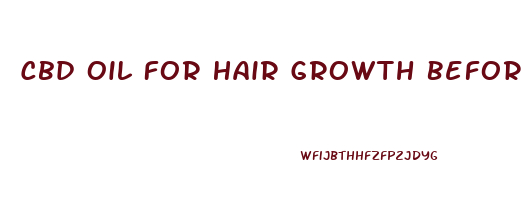 Cbd Oil For Hair Growth Before And After