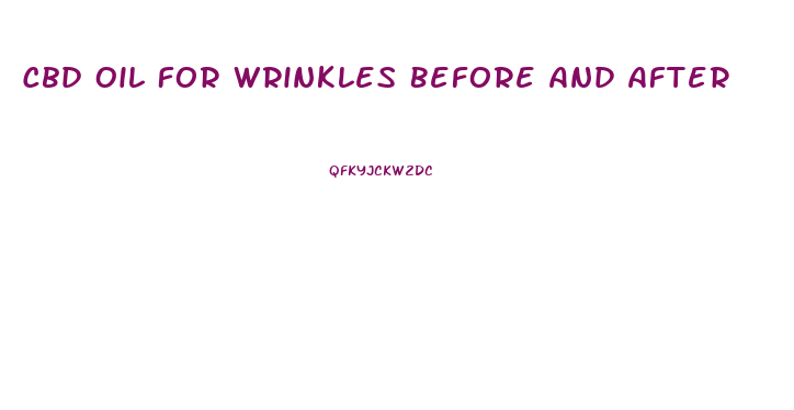 Cbd Oil For Wrinkles Before And After
