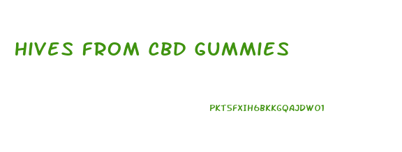 Hives From Cbd Gummies