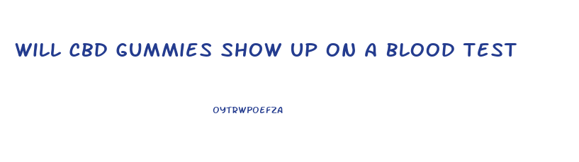 Will Cbd Gummies Show Up On A Blood Test
