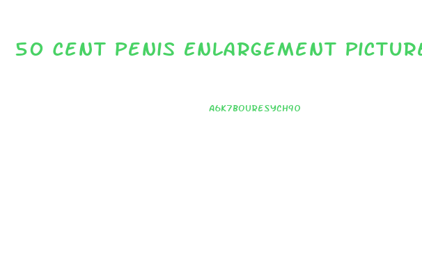 50 Cent Penis Enlargement Picture