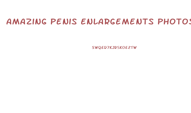 Amazing Penis Enlargements Photos