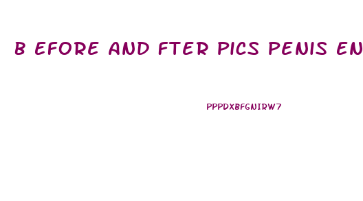 B Efore And Fter Pics Penis Enlarge Surgery