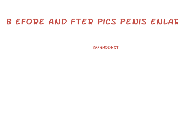 B Efore And Fter Pics Penis Enlarge Surgery