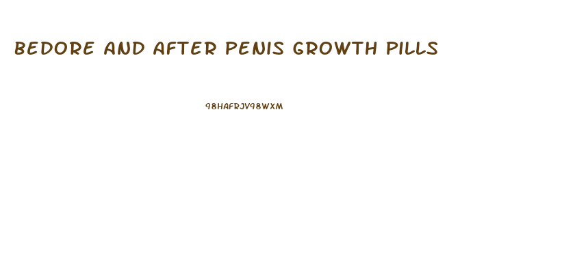 Bedore And After Penis Growth Pills
