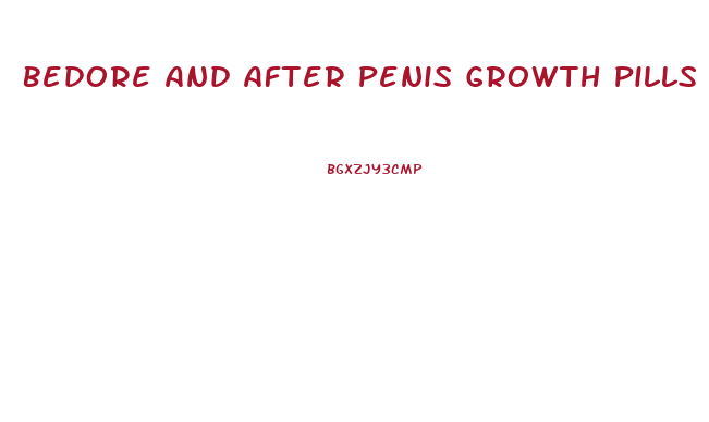 Bedore And After Penis Growth Pills