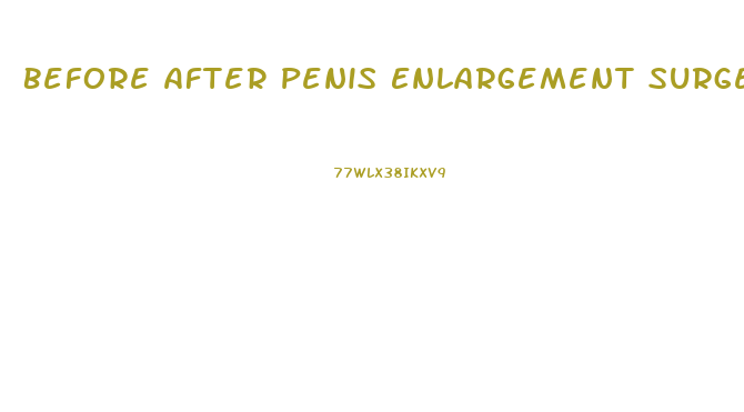 Before After Penis Enlargement Surgery