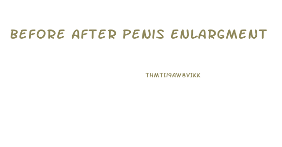 Before After Penis Enlargment