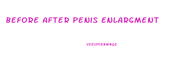 Before After Penis Enlargment