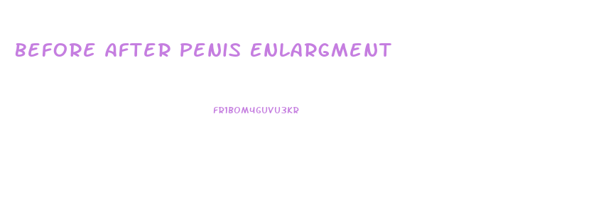 Before After Penis Enlargment
