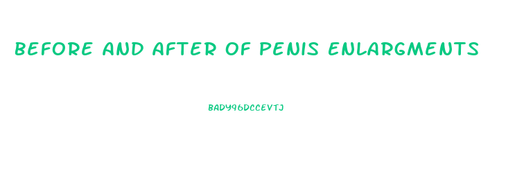 Before And After Of Penis Enlargments