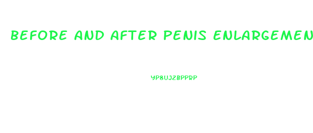 Before And After Penis Enlargement Bible