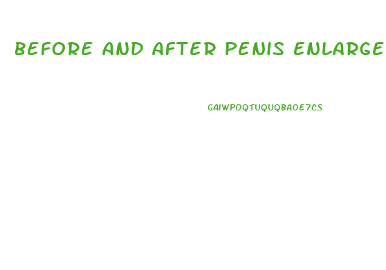 Before And After Penis Enlargement Erect