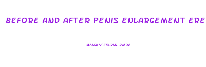 Before And After Penis Enlargement Erect
