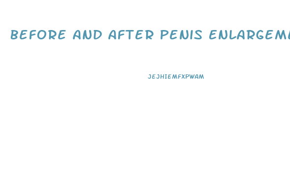 Before And After Penis Enlargement Reddit