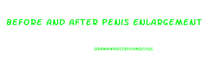 Before And After Penis Enlargement