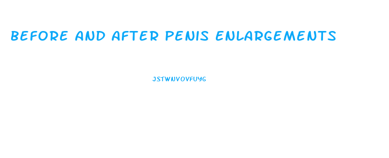 Before And After Penis Enlargements