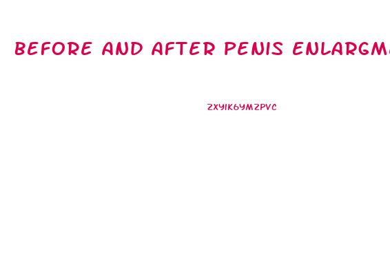 Before And After Penis Enlargment Pumps Supplements
