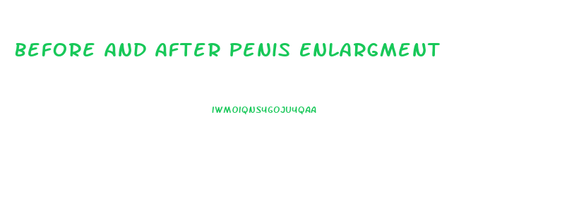 Before And After Penis Enlargment