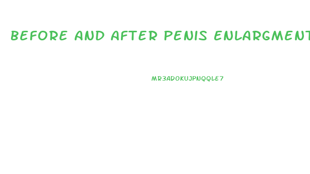 Before And After Penis Enlargment
