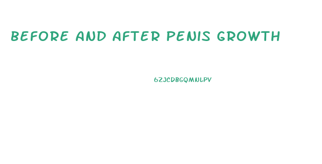 Before And After Penis Growth