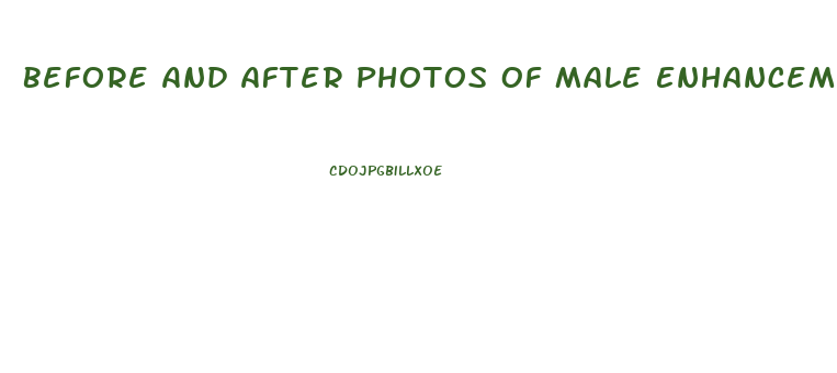 Before And After Photos Of Male Enhancement