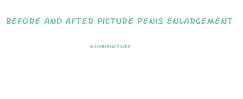 Before And After Picture Penis Enlargement
