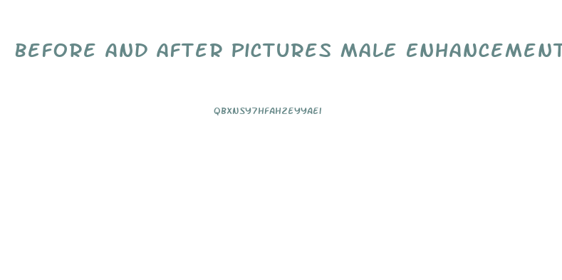 Before And After Pictures Male Enhancement