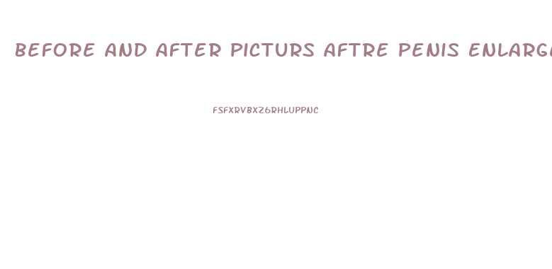 Before And After Picturs Aftre Penis Enlargement