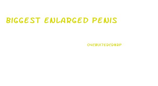 Biggest Enlarged Penis