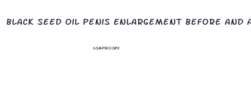 Black Seed Oil Penis Enlargement Before And After