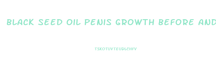 Black Seed Oil Penis Growth Before And After