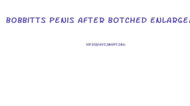 Bobbitts Penis After Botched Enlargement Surgery