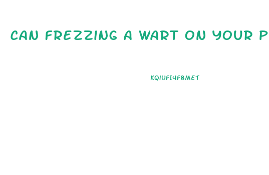 Can Frezzing A Wart On Your Penis Stop Its Growth