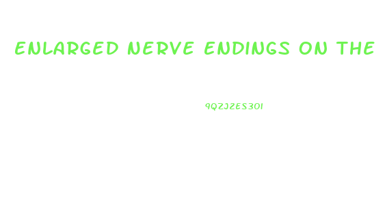 Enlarged Nerve Endings On The Penis