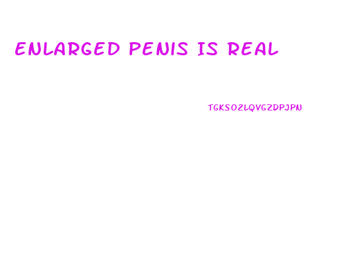 Enlarged Penis Is Real