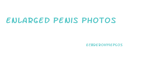 Enlarged Penis Photos
