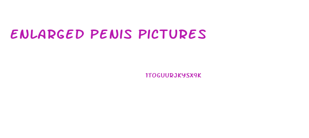 Enlarged Penis Pictures