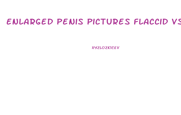 Enlarged Penis Pictures Flaccid Vs Erect