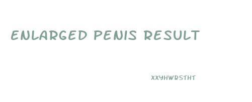 Enlarged Penis Result